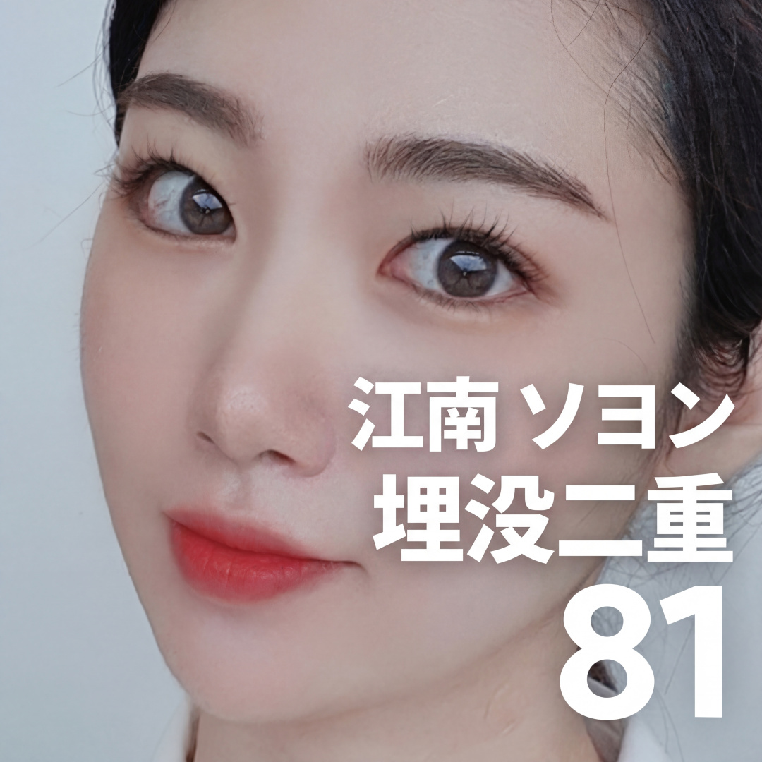 Gangnam Seoyeon Bấm mí