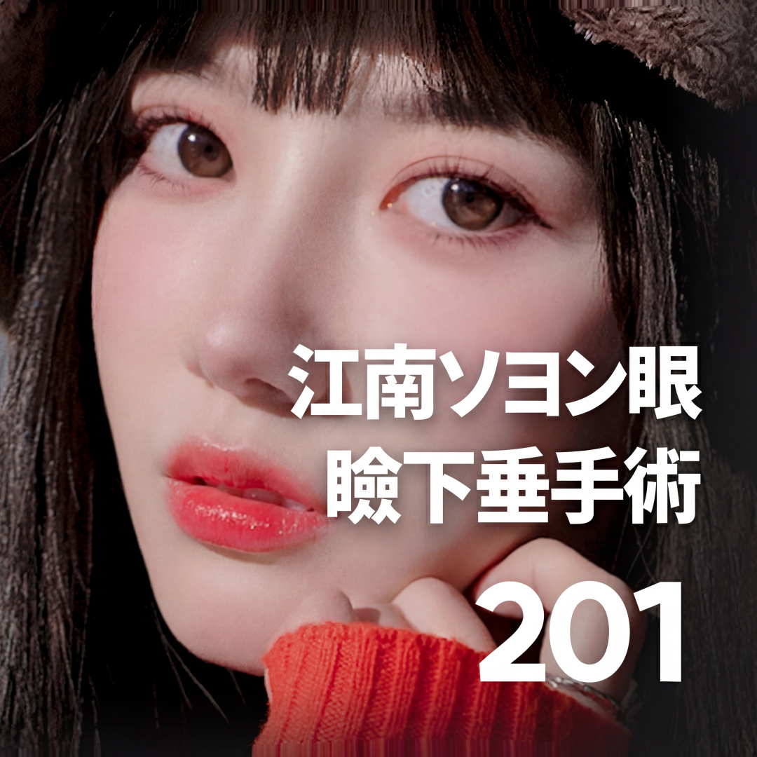 Gangnam Seoyeon Chỉnh hình mắt