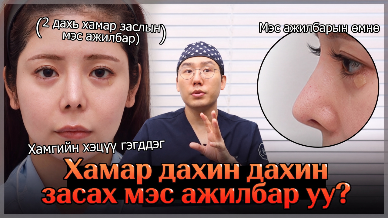 Хамгийн хэцүү гэгддэг хамрын давтан мэс засал? 😭